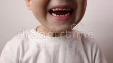 把男孩的牙齿贴紧。 保健、牙齿卫生、牙齿问题、龋齿